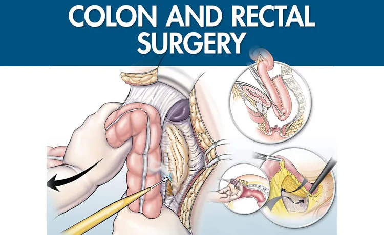 COLON AND RECTAL SURGERY